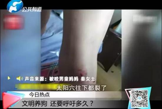 郑州5岁男孩地上重伤脸部城市“狗患”问题引关注